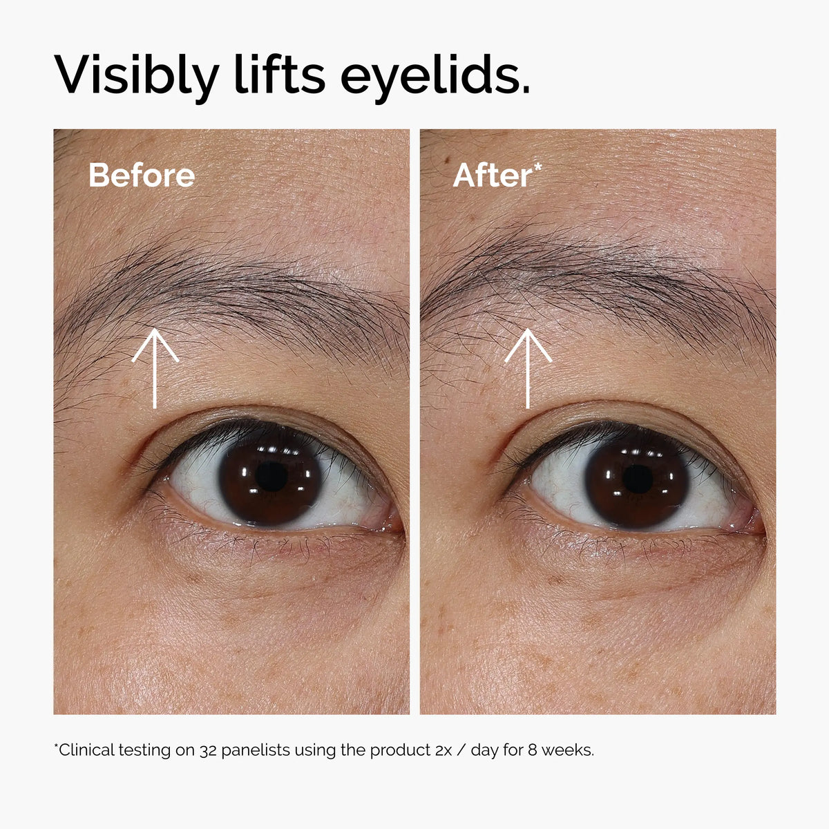 🎀Lacto-PDRN 4% + B9 Eye Cream – Lifting & Firming Eye Treatment