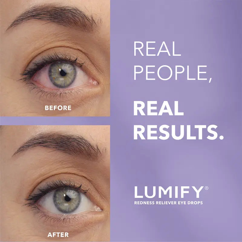 ❤️Fast-Acting Redness Relief Eye Drops – 2.5mL