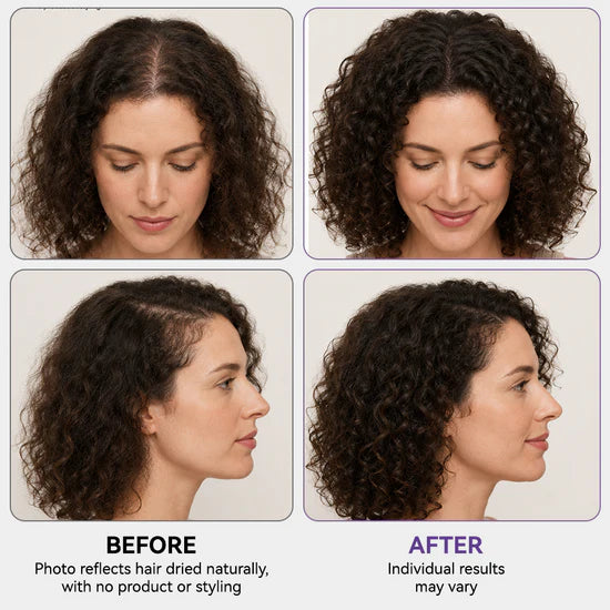 Roll & Grow! ✨ Hair Thickening Roll-On Serum for Scalp Revitalization