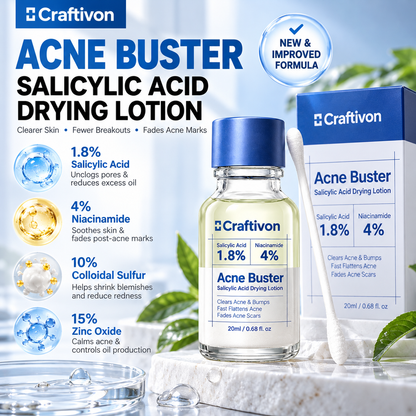 ⭐ 1.8% Salicylic Acid Acne Spot Treatment – Targeted Drying Lotion for Breakouts