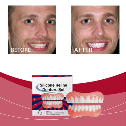 🎁Snap-On Teeth Veneers Set – Removable Upper & Lower Cosmetic Smile Covers