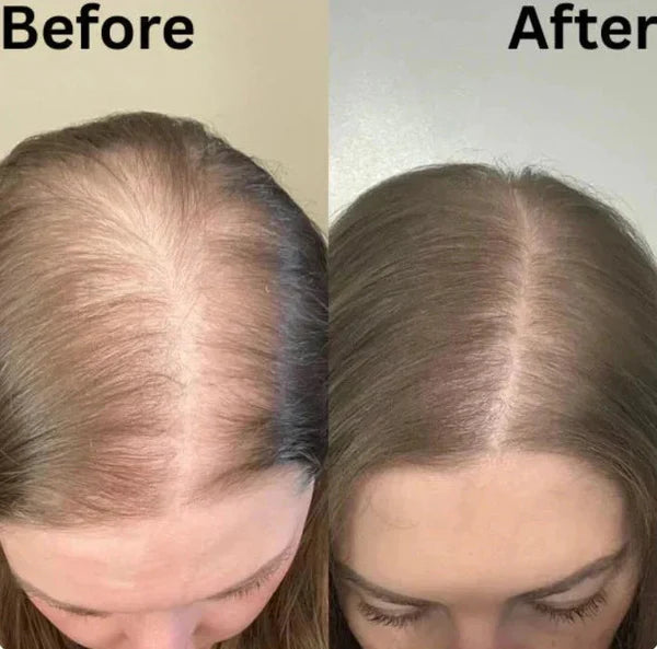 🔥 Champú Fortificante de Romero | Un cabello de aspecto más sano empieza en el cuero cabelludo