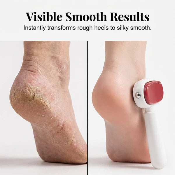 Dual-Sided Foot Callus Remover – Replaceable Stainless Steel Scraper