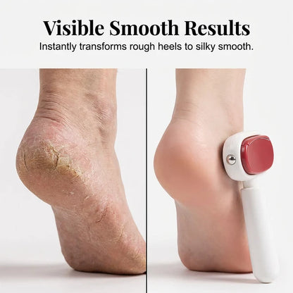 Dual-Sided Foot Callus Remover – Replaceable Stainless Steel Scraper