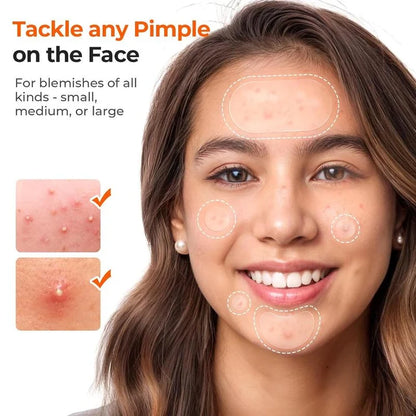 🔥Hydrocolloid Acne Cover Patches