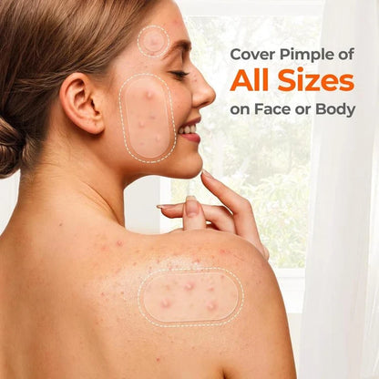 🔥Hydrocolloid Acne Cover Patches