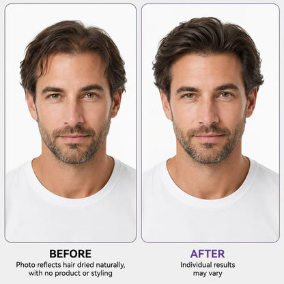 Roll & Grow! ✨ Hair Thickening Roll-On Serum for Scalp Revitalization