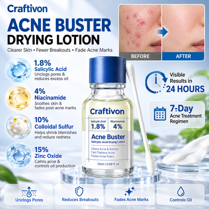 ⭐ 1.8% Salicylic Acid Acne Spot Treatment – Targeted Drying Lotion for Breakouts