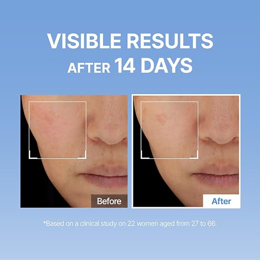 ⭐Hyaluronic Acid Serum – Deep Hydration for a Fresh, Dewy Glow