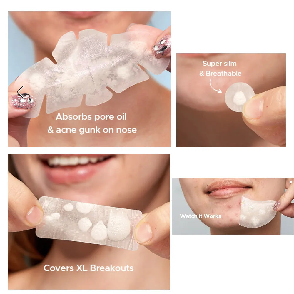 🎁532 Pimple Patches – Hydrocolloid Acne Patches, 5 Sizes, Waterproof Blemish Covers for Face, Nose, Back & Chest