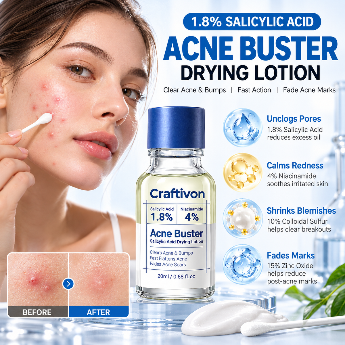 ⭐ 1.8% Salicylic Acid Acne Spot Treatment – Targeted Drying Lotion for Breakouts