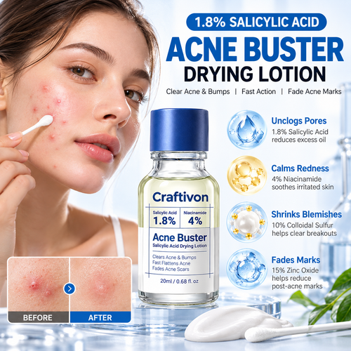 ⭐ 1.8% Salicylic Acid Acne Spot Treatment – Targeted Drying Lotion for Breakouts