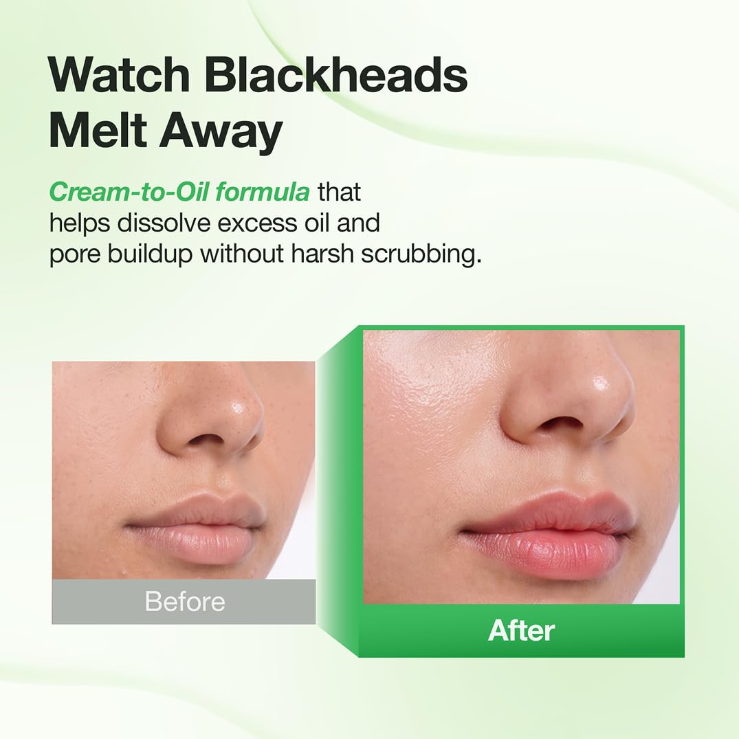 ⭐Blackhead Melting Cream-to-Oil Exfoliator