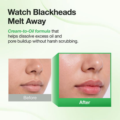 ⭐Blackhead Melting Cream-to-Oil Exfoliator