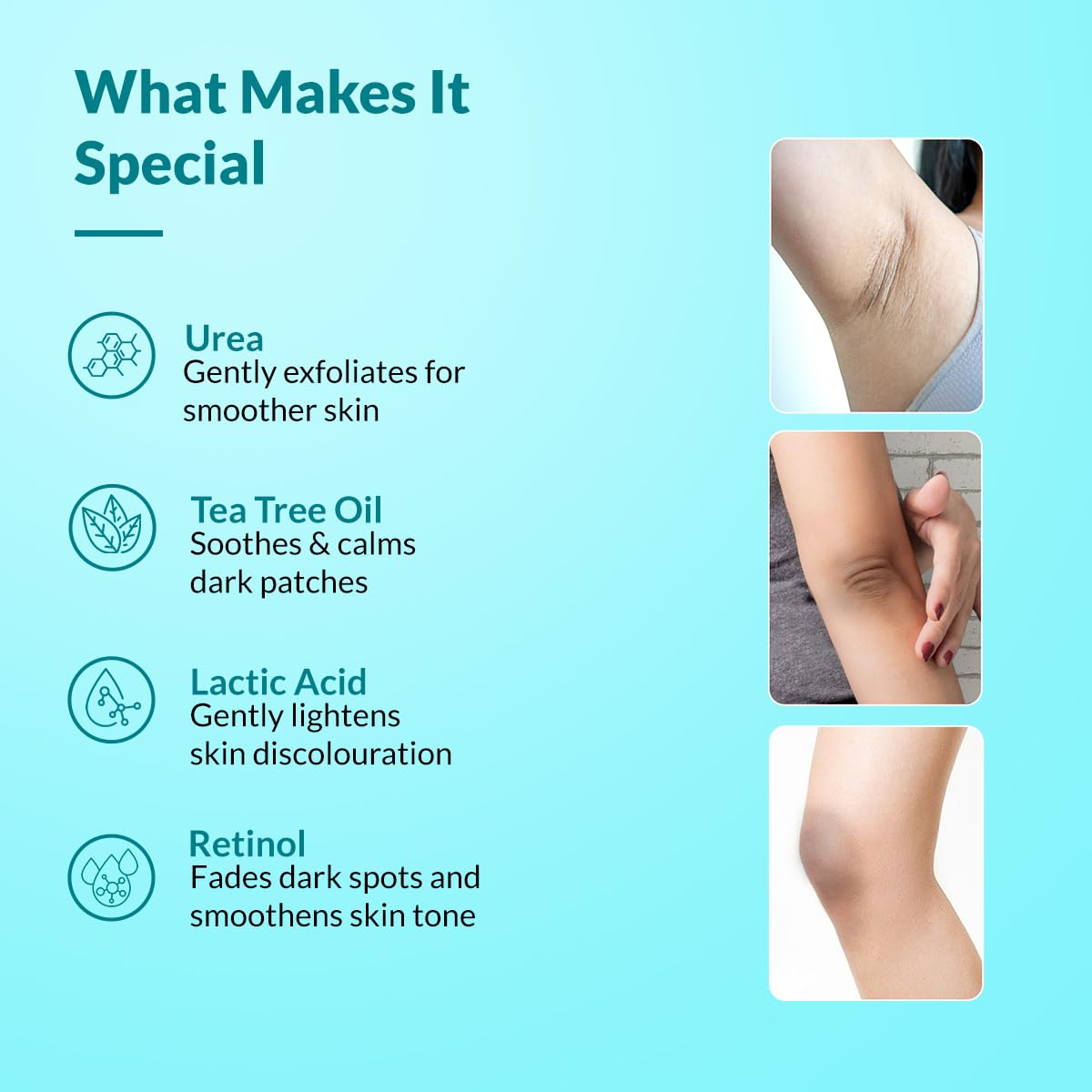✨ Targeted Dark Spot Body Cream — Smooth, Exfoliate & Hydrate with Lactic Acid + Retinol