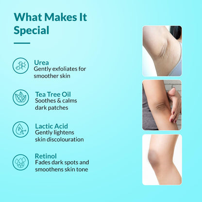 ✨ Targeted Dark Spot Body Cream — Smooth, Exfoliate & Hydrate with Lactic Acid + Retinol