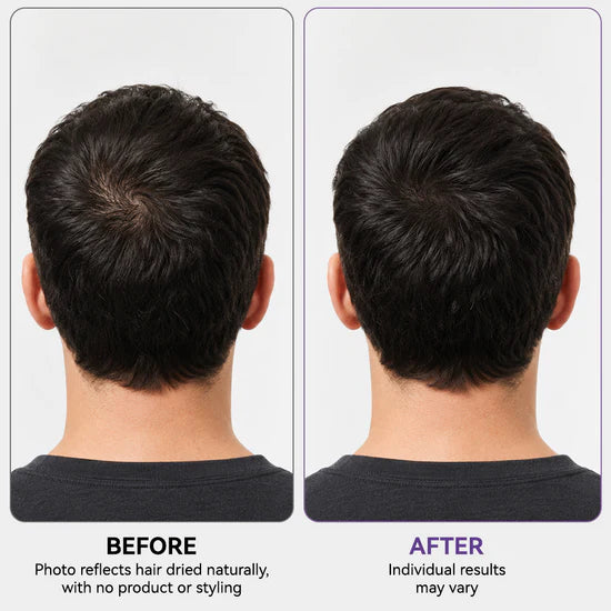 Roll & Grow! ✨ Hair Thickening Roll-On Serum for Scalp Revitalization