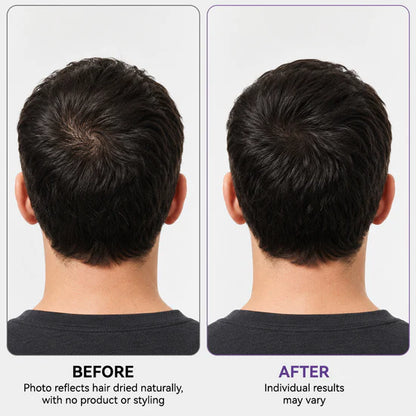 Roll & Grow! ✨ Hair Thickening Roll-On Serum for Scalp Revitalization
