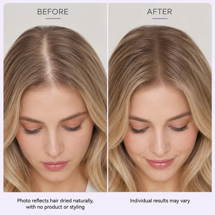 Roll & Grow! ✨ Hair Thickening Roll-On Serum for Scalp Revitalization