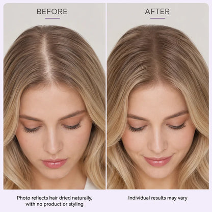 Roll & Grow! ✨ Hair Thickening Roll-On Serum for Scalp Revitalization