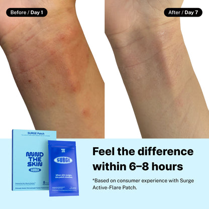 🔥Active Flare Hydrocolloid Patches