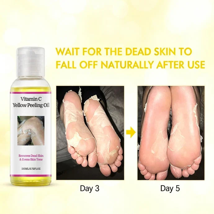 🎁Yellow Peeling Oil – Deep Exfoliating Body Peel for Rough, Dull Skin