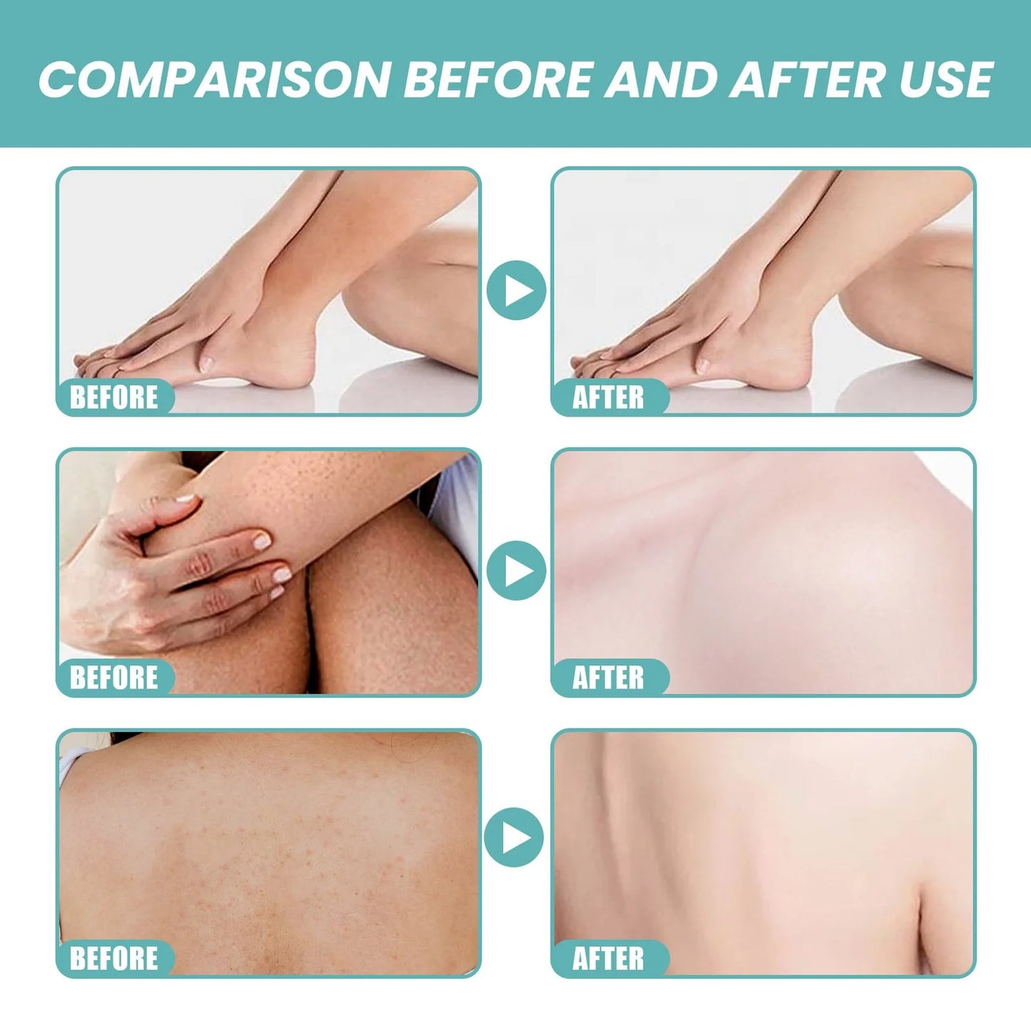 Bath Oil – Hydrates Dry Skin While Helping Repel Mosquitoes