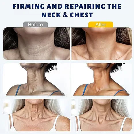 🧴Collagen Roller Neck Firming Cream | Hydrating & Smoothing Neck Care