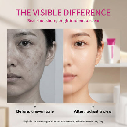 💎 High-Active Brightening Care — 7% Arbutin + 4% TXA Cream