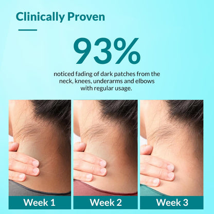 ✨ Targeted Dark Spot Body Cream — Smooth, Exfoliate & Hydrate with Lactic Acid + Retinol