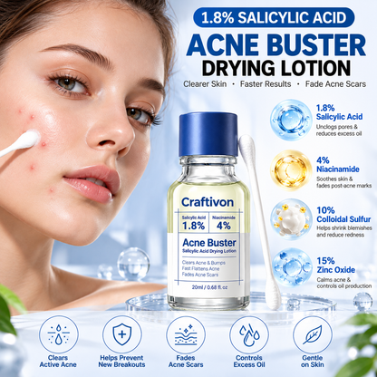 ⭐ 1.8% Salicylic Acid Acne Spot Treatment – Targeted Drying Lotion for Breakouts