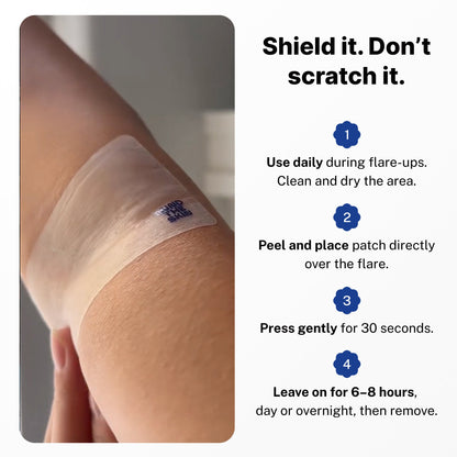 🔥Active Flare Hydrocolloid Patches