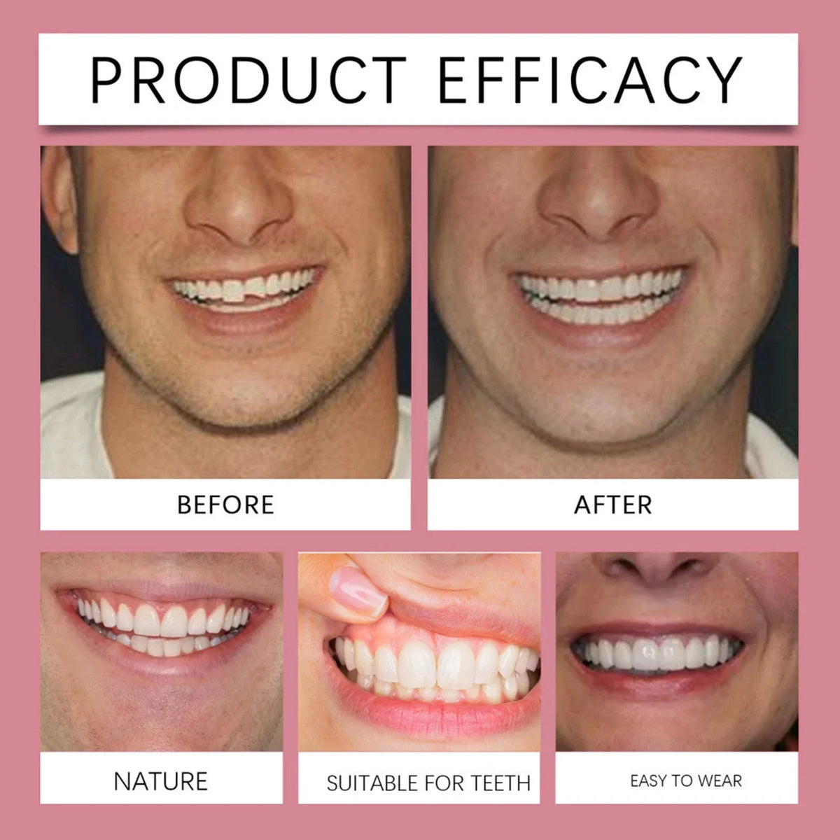 🎁Snap-On Teeth Veneers Set – Removable Upper & Lower Cosmetic Smile Covers