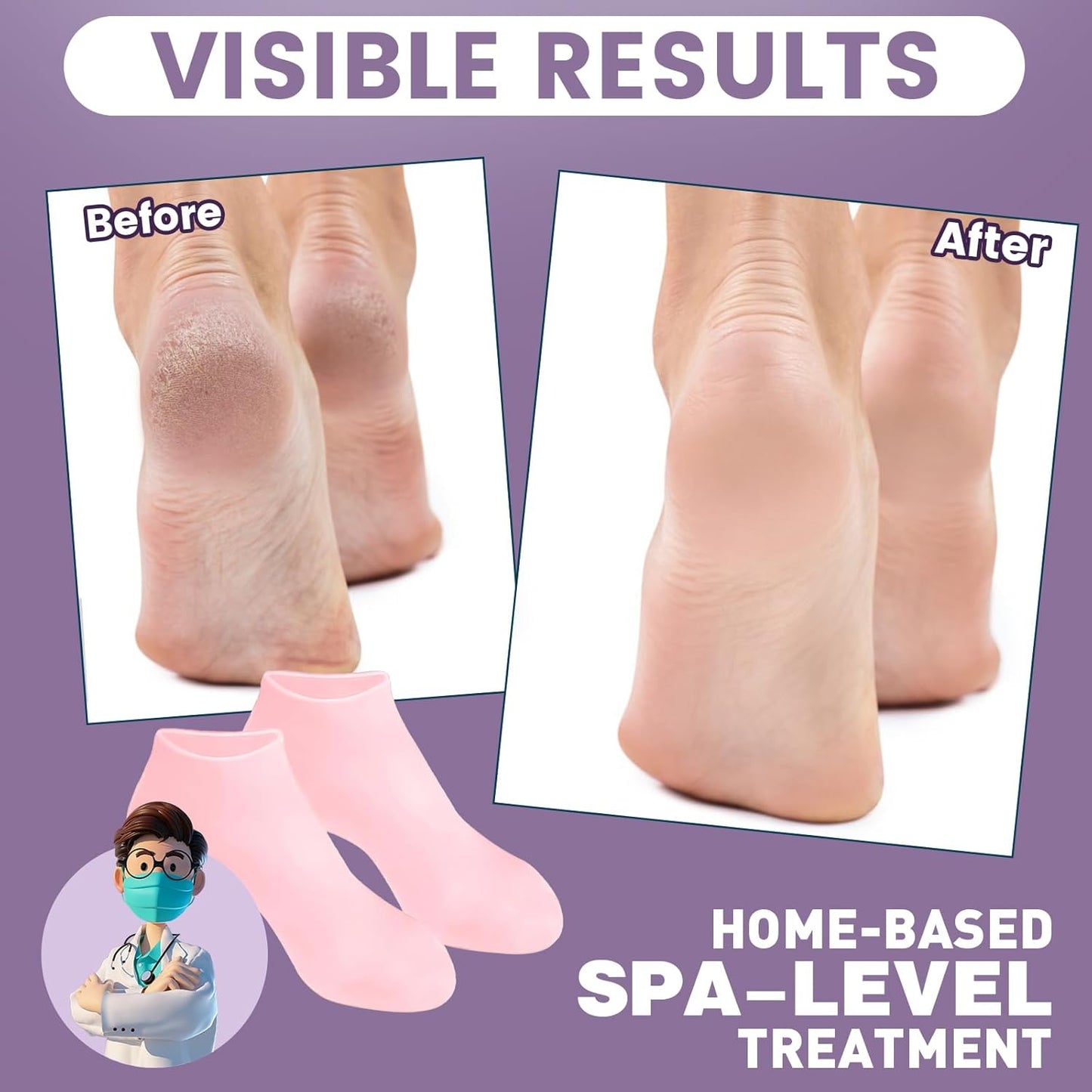 Silicone Socks for Dry Cracked Feet - Women's Moisturizing Foot Socks