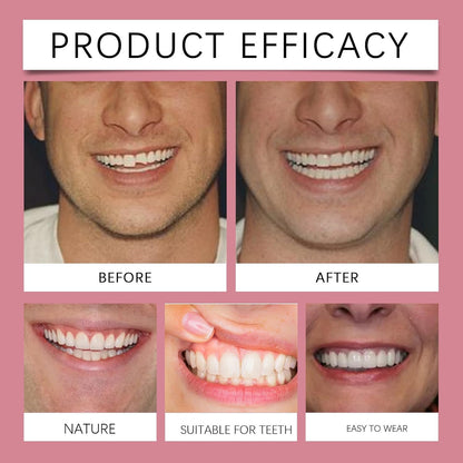 ❤️Temporary Snap-On Veneers – Removable Smile Covers