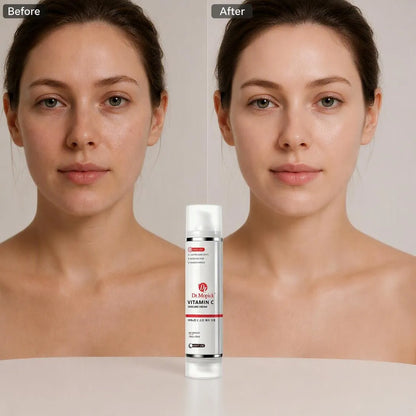 Tranexamic Acid Vitamin C Brightening Moisturizer Cream