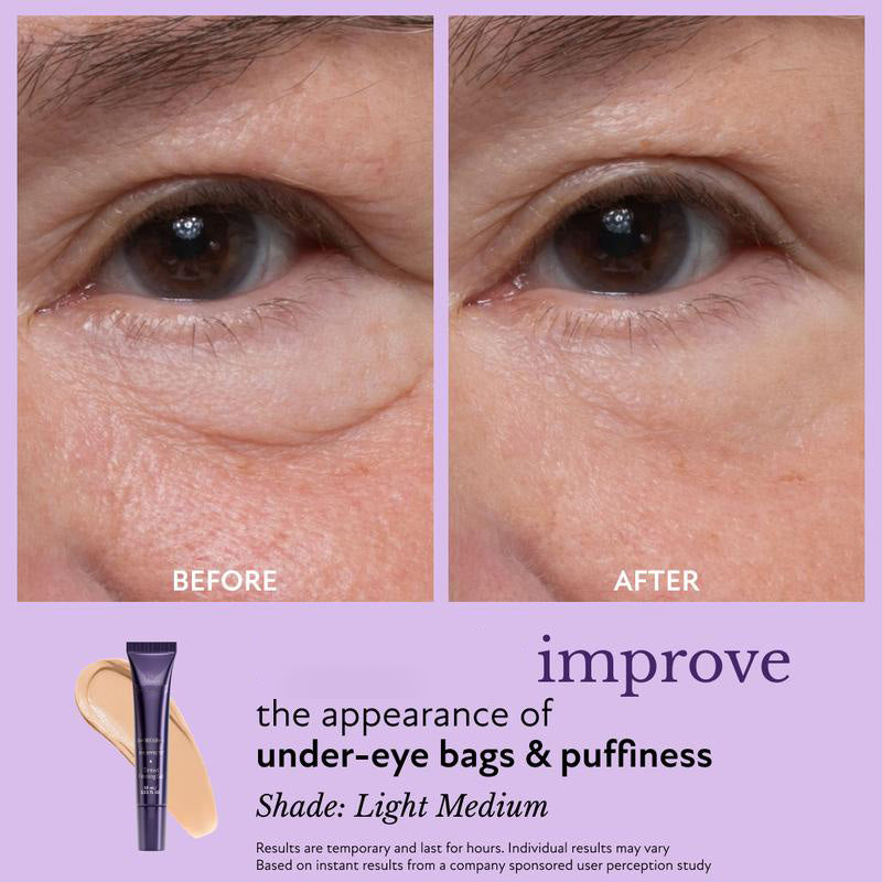 ⏱️Eye Effects-Reduce the Appearance of Puffiness, Fine Lines, Wrinkles, and Under-Eye Circles