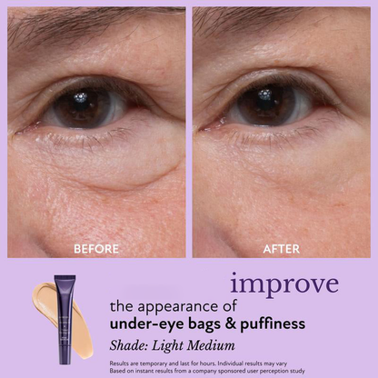 ⏱️Eye Effects-Reduce the Appearance of Puffiness, Fine Lines, Wrinkles, and Under-Eye Circles