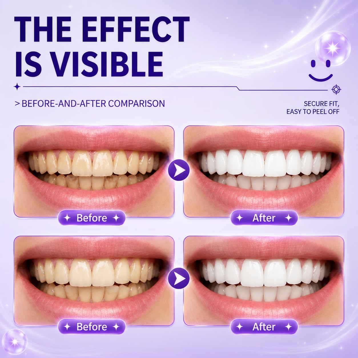 💜 Purple Teeth Whitening Strips — PAP-Powered, Peroxide-Free Brightening for a Whiter-Looking Smile