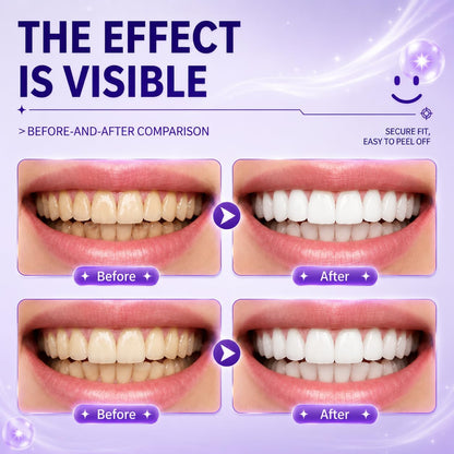 💜 Purple Teeth Whitening Strips — PAP-Powered, Peroxide-Free Brightening for a Whiter-Looking Smile