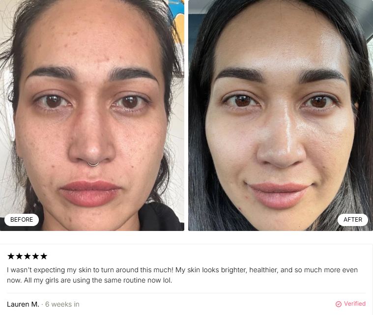 🔥Glutathione 7 Dark Spot Duo