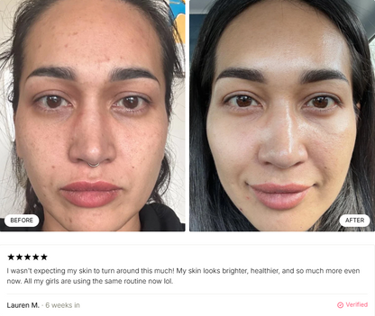 🔥Glutathione 7 Dark Spot Duo