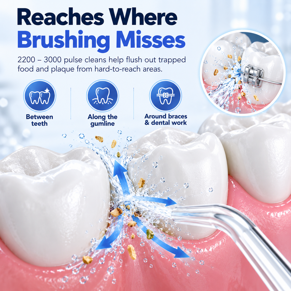 🔥Electric Water Flosser, Teeth Cleaning with 4 Jet Tips