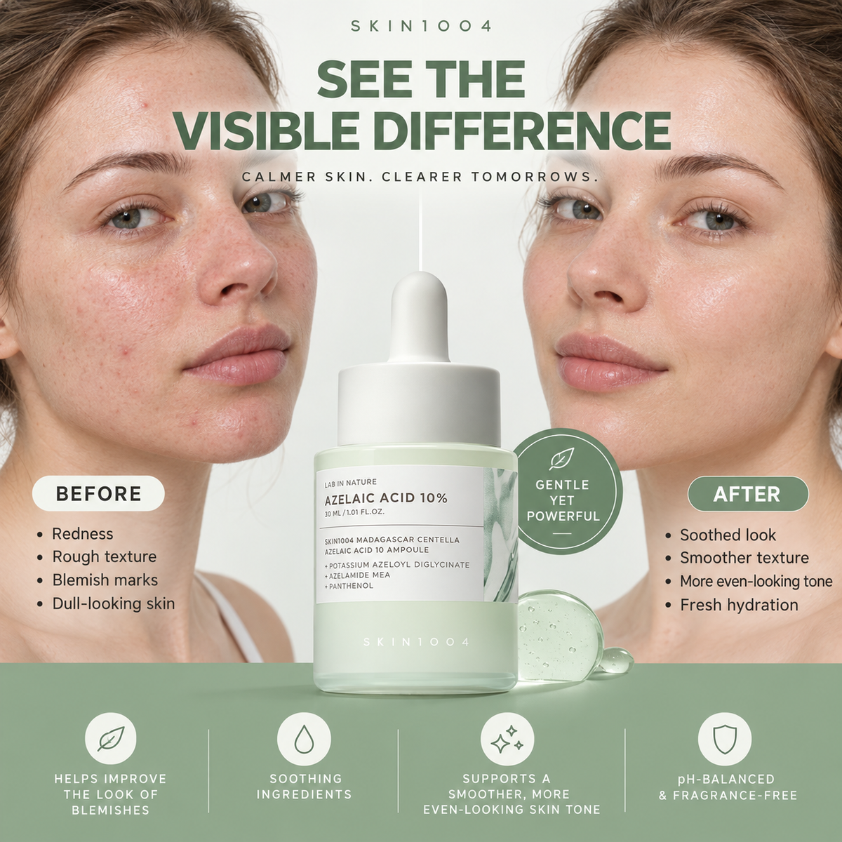 ❤️Azelaic Acid 10% Blemish Care Ampoule – 30ml