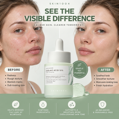 ❤️Azelaic Acid 10% Blemish Care Ampoule – 30ml