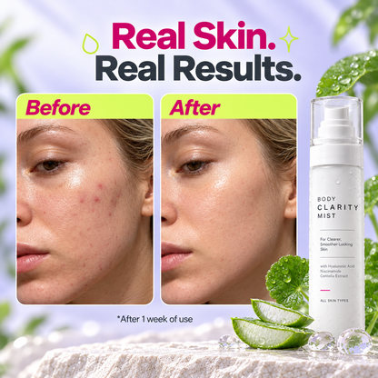 ✨Body Clarity Mist💧Ultra-Fine Spray for Back, Chest & Shoulder Care, 100 mL🌿