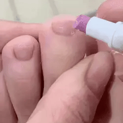 💅 Nail & Cuticle Rescue Pen
