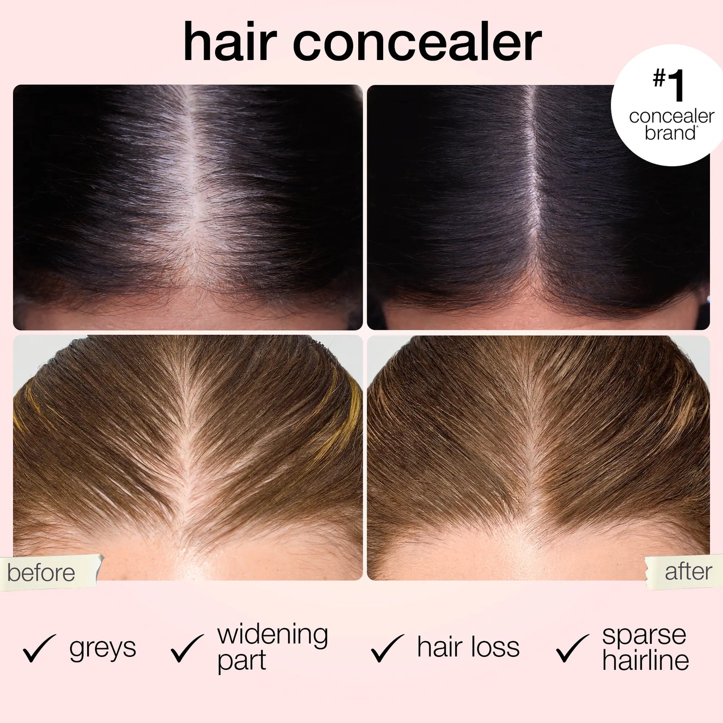 ✨ Instant Hairline Concealer – Fuller-Looking Roots in Seconds