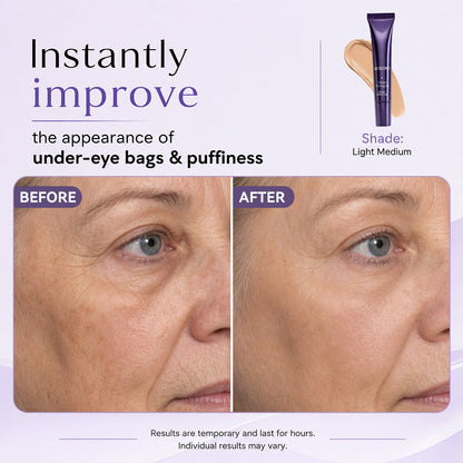 😱 Watch Your Eye Bags Disappear in 60 Seconds | Instant Eye Lift Effect