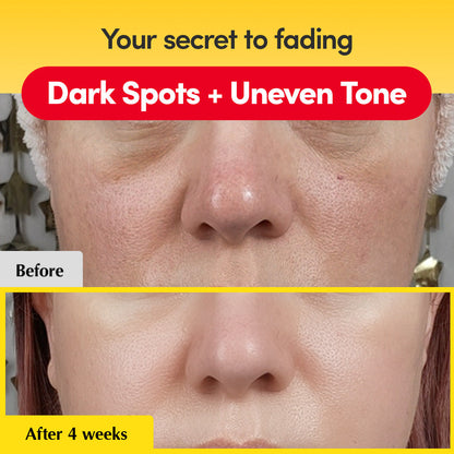 Vitamin Illuminating Dark Spot Serum